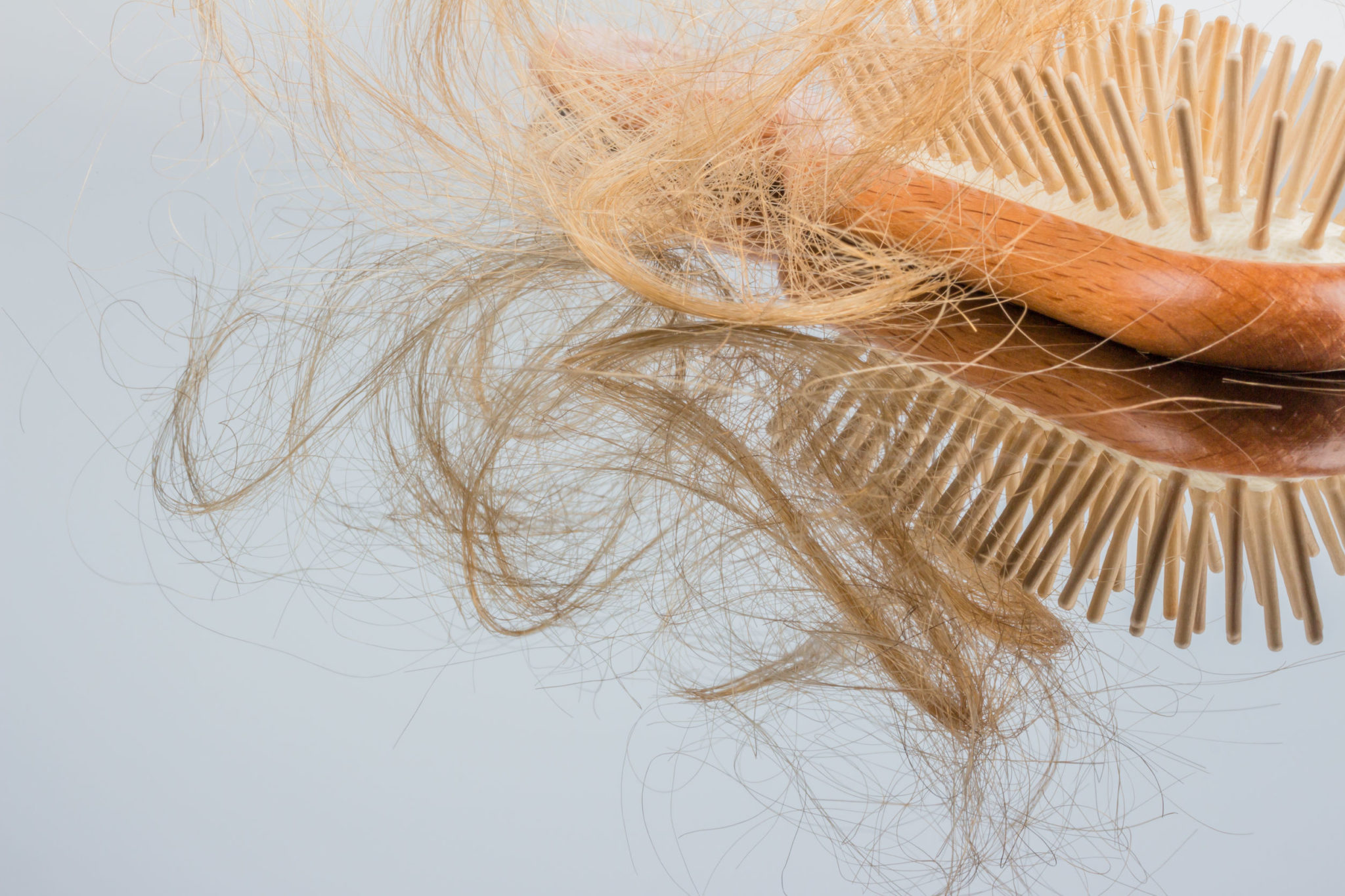 What Are the Risk Factors for Hair Loss