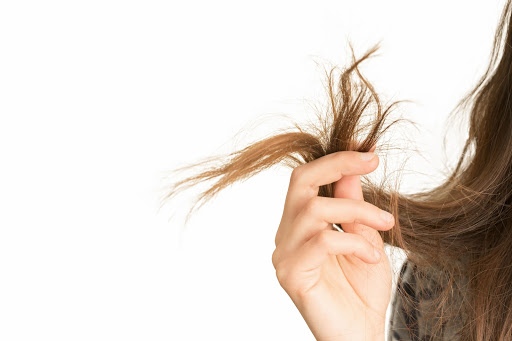 Nonmedical Causes of Hair Loss
